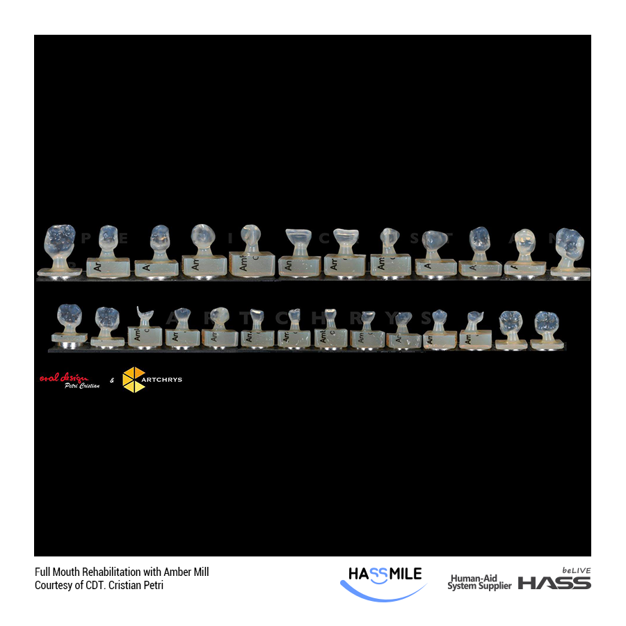 Full Mouth Rehabilitation with Amber Mill