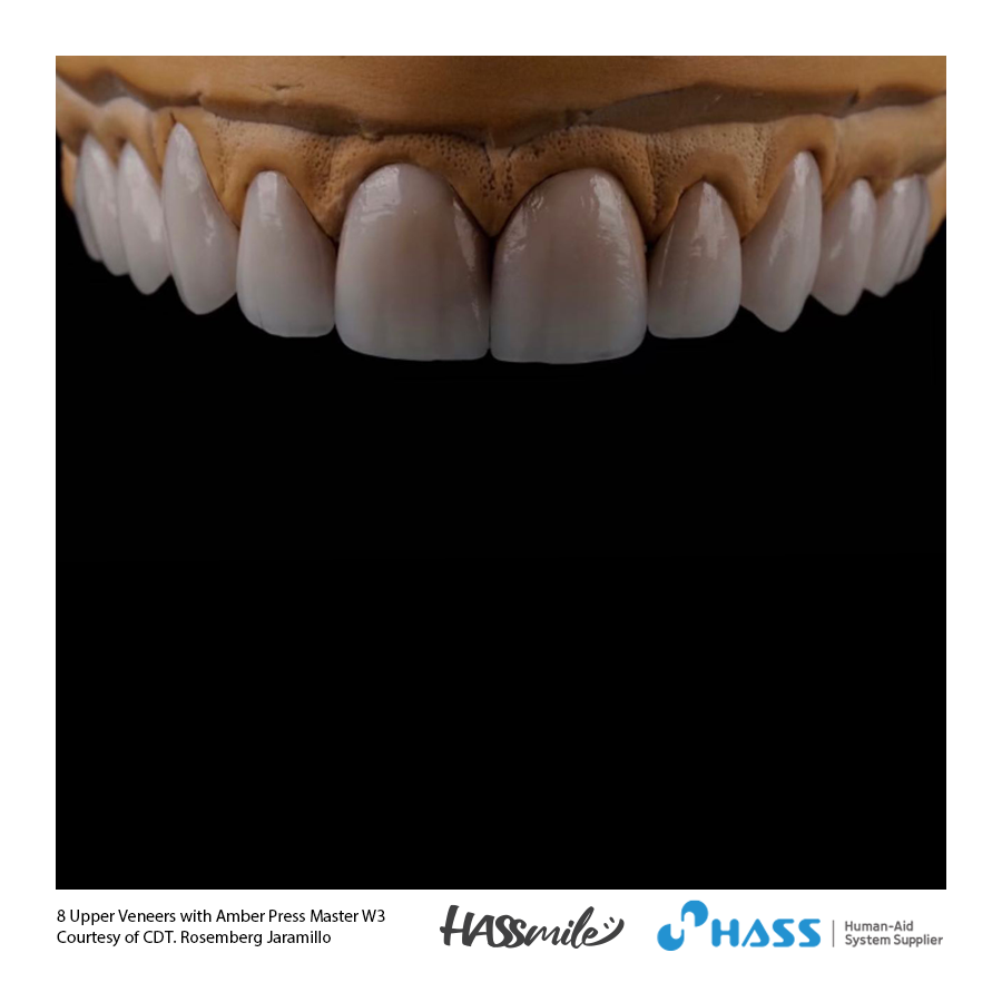 8 Upper Veneers with Amber Press Master W3