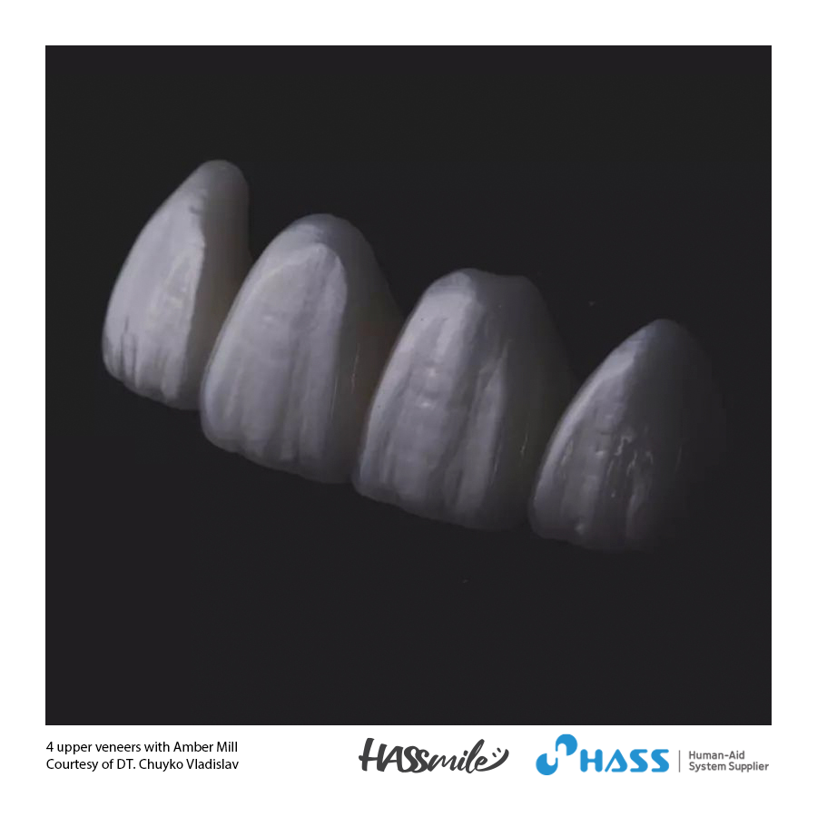 4 upper veneers with Amber Mill