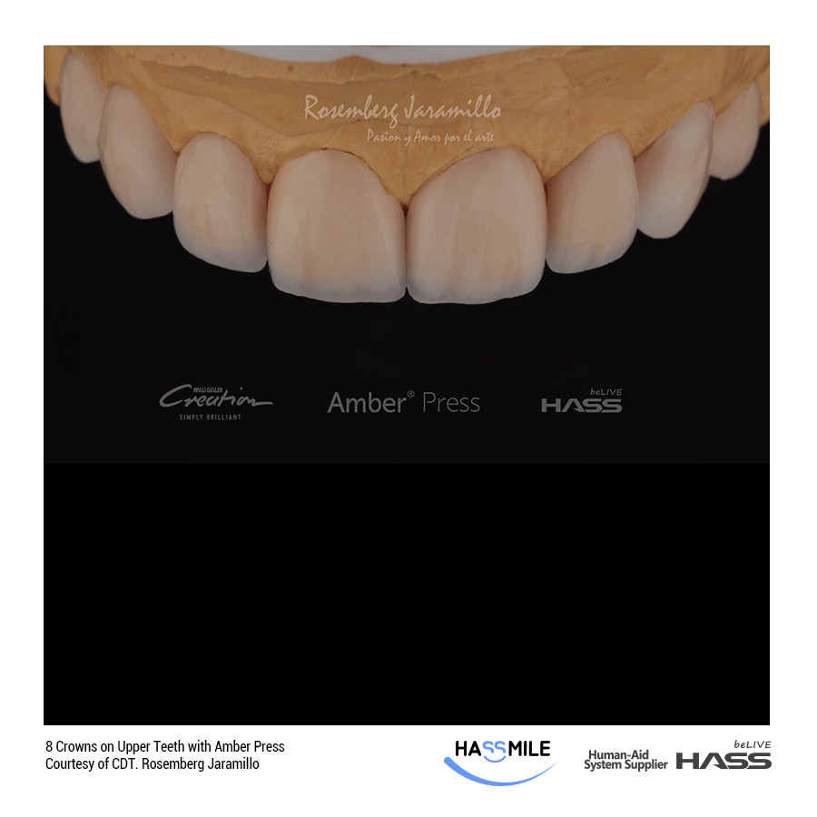 8 Crowns on Upper Teeth with Amber Press