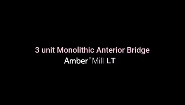 [Product] Amber Mill 3 unit Monolithic Anterior Bridge