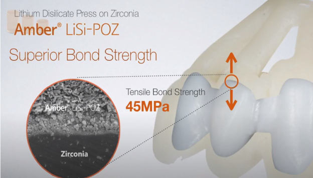 [Product] Amber LiSi-POZ _ LPZ (Lithium Disilicate-Based Press on Zirconia)