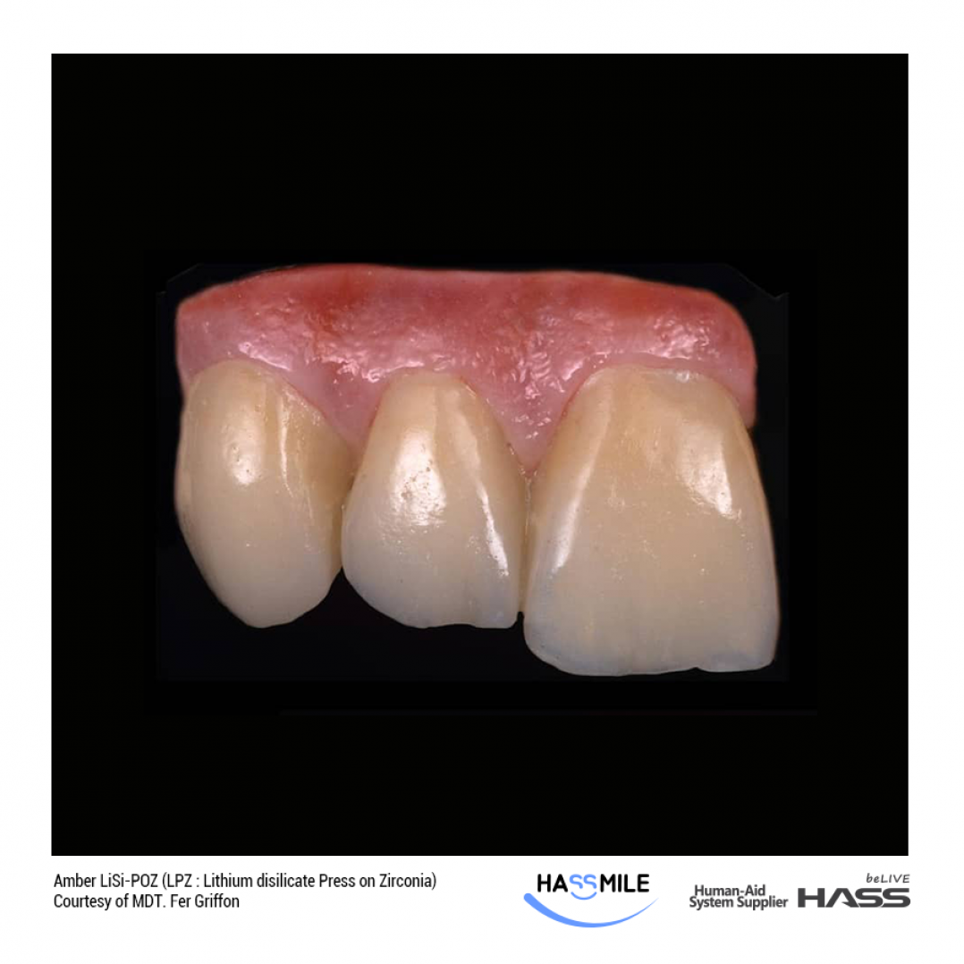 Amber LiSi-POZ (LPZ : Lithium disilicate Press on Zirconia)