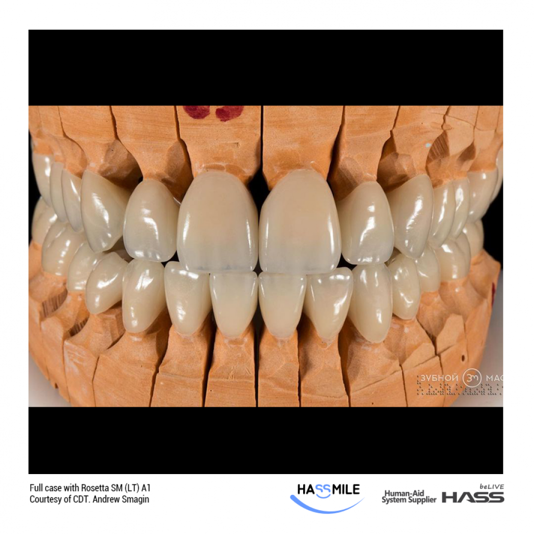 HASSBIO RosettaSM Lithium-disilicate CAD CAM