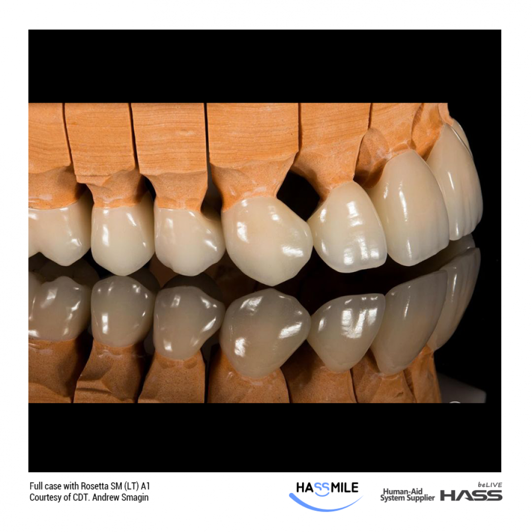 HASSBIO RosettaSM Lithium-disilicate CAD CAM