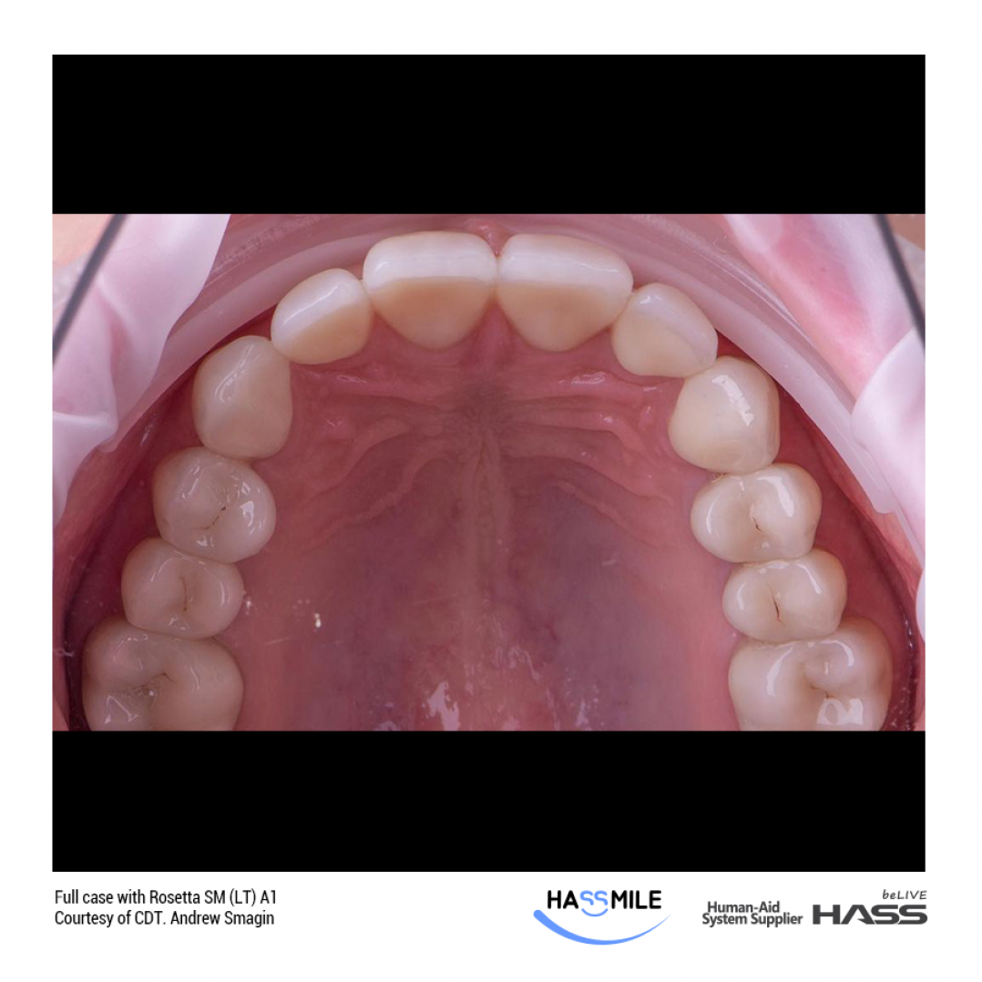 HASSBIO RosettaSM Lithium-disilicate CAD CAM