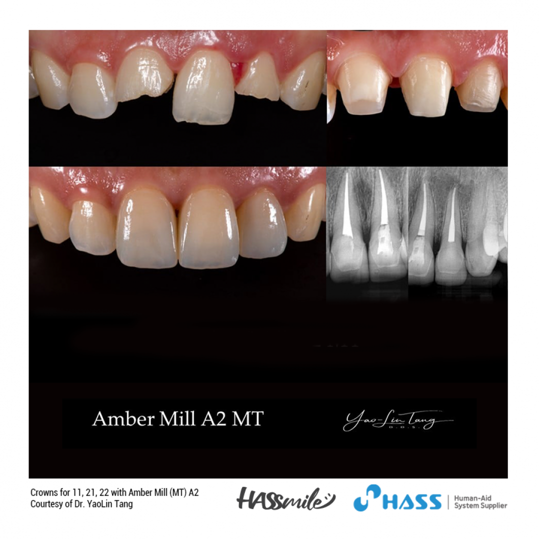 HASSBIO AmberMill NLD Lithium-disilicate CADCAM