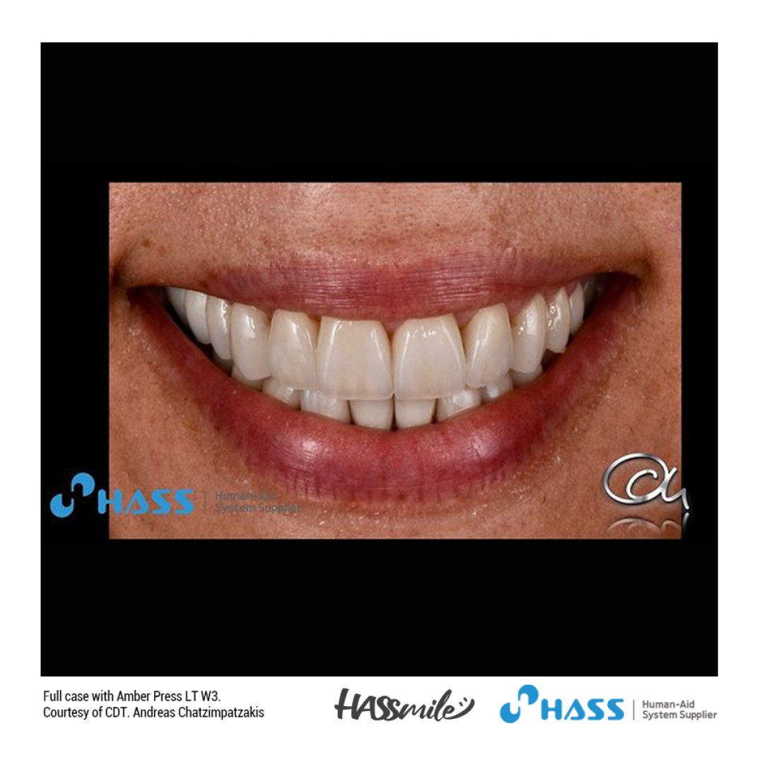 HASSBIO AmberPress Lithium-disilicate dental-press glass-ceramics