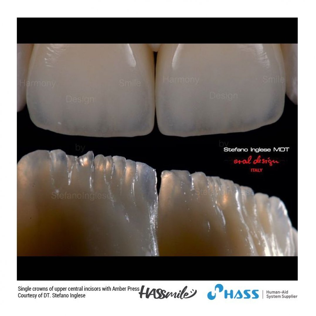 HASSBIO AmberPress Lithium-disilicate dental-press dentalcrowns