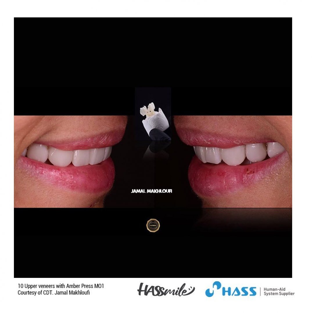 HASSBIO AmberPress dental-press Lithium-disilicate