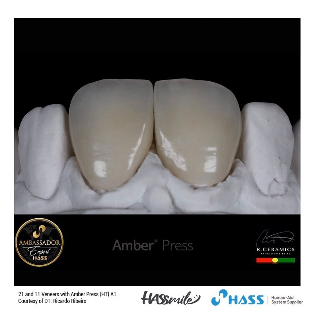 HASSBIO AmberPress Lithium-disilicate dental-press glassceramicingots HASSveneers