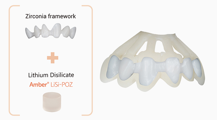 New Era of Dental Restorations